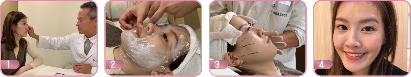 舒顏萃治療過程