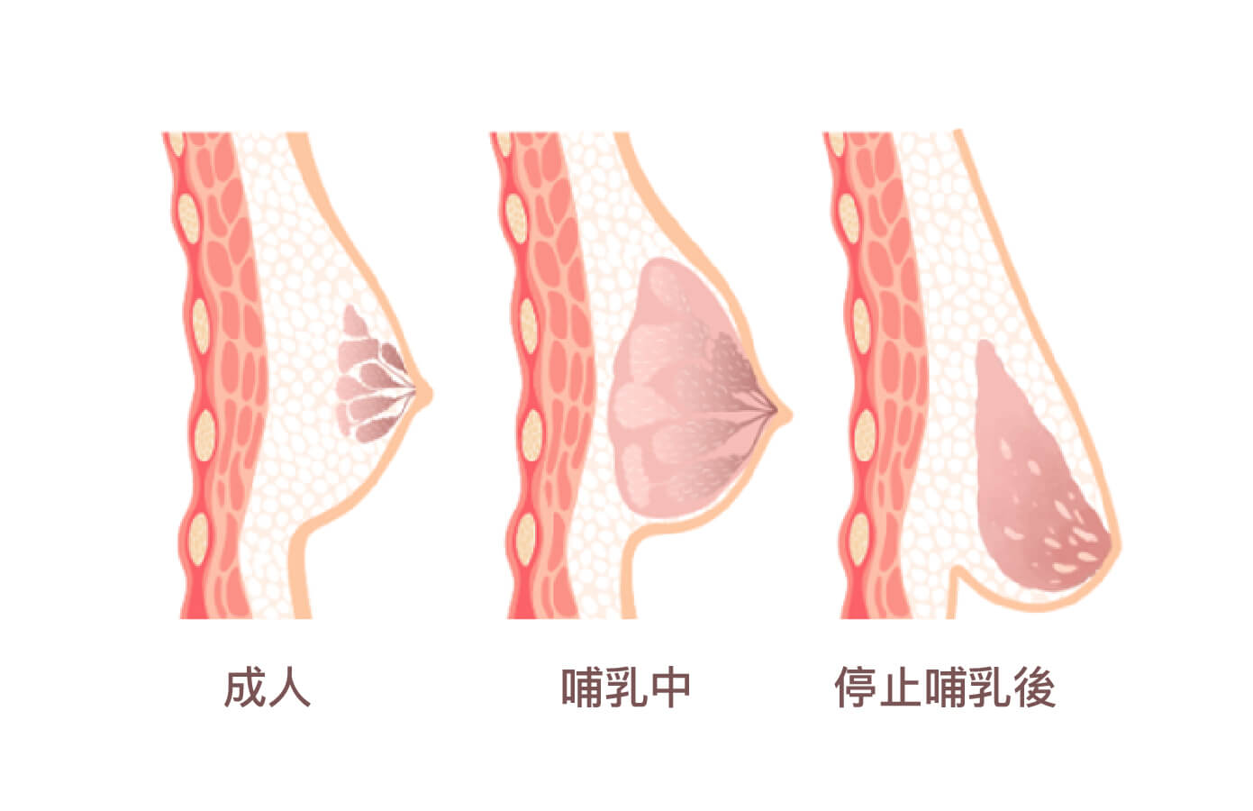 哺乳造成胸部萎縮