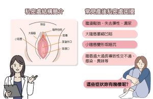 產後私密處常見問題