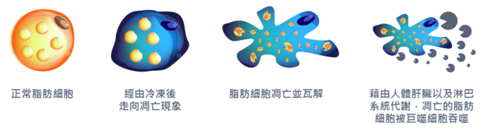 冷凍減脂效果