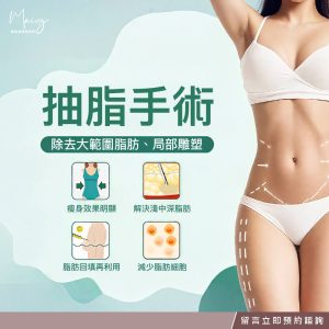 抽脂手術專案100000