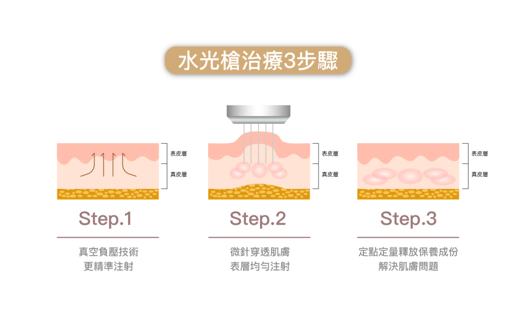 水光槍療程步驟