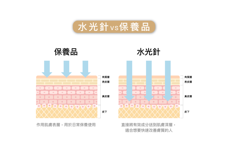 水光針與一般保養品差異