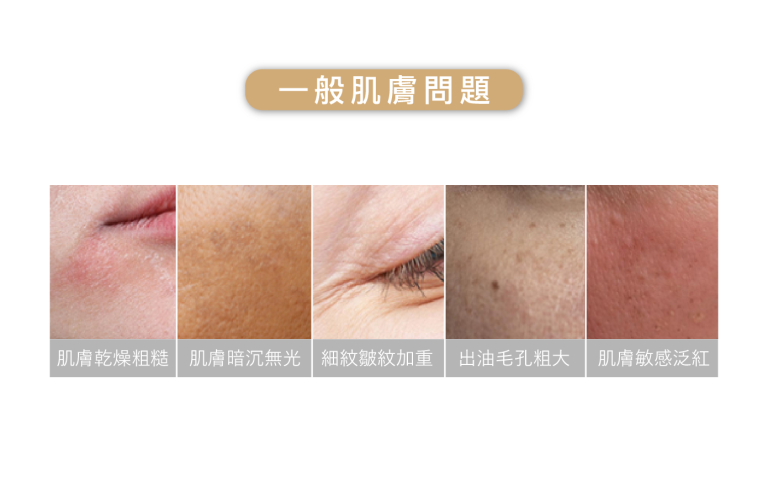 水光針適用部位