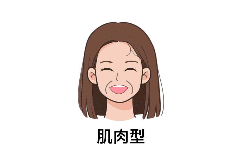 肌肉型法令紋