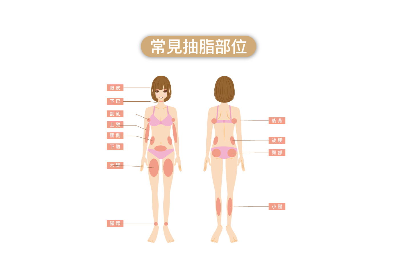 常見抽脂部位