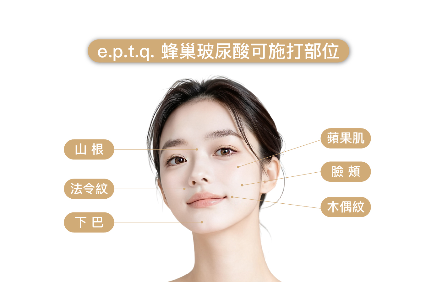 蜂巢玻尿酸適用部位